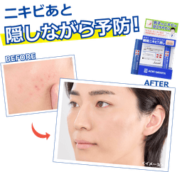 石澤研究所 男士暗瘡屏障藥用遮瑕棒 5g