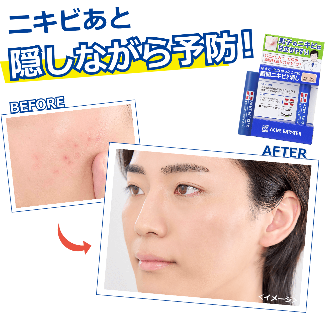 石澤研究所 男士暗瘡屏障藥用遮瑕棒 5g