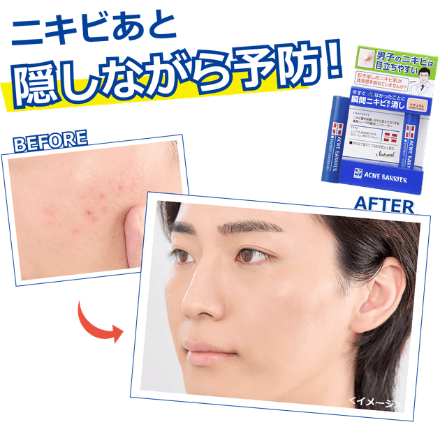 Ishizawa Lab 石澤研究所 男士暗瘡屏障藥用遮瑕棒 5g — Archer 男士護膚化妝