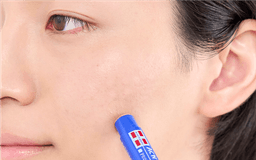 石澤研究所 男士暗瘡屏障藥用遮瑕棒 5g