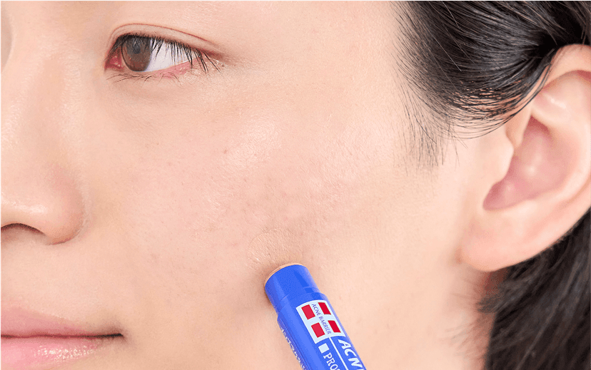 石澤研究所 男士暗瘡屏障藥用遮瑕棒 5g